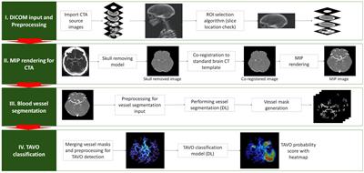 Automated identification of thrombectomy amenable vessel occlusion on computed tomography angiography using deep learning